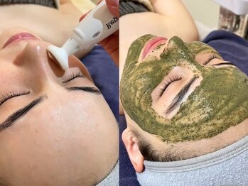 バイ リス(by LYS.)の写真/シミ改善×透明感爆上げ!プラズマシミケアコース ¥15,400→シミだけじゃない!毛穴・くすみ改善で悩み解決◎
