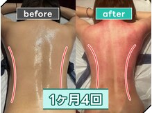 痩身革命 大宮店/ダイエットリンパマッサージ