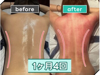 痩身革命 大宮店/ダイエットリンパマッサージ