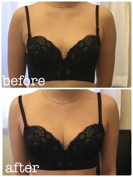 サロン ワン(salon one)/ビフォーアフター