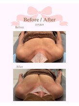 ロココ 安城店(Rococo)/バストアップ症例