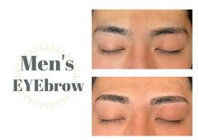 ヴィーナス アイビューティー(VENUS Eye Beauty)