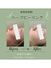 ニキビケアの近道！ハーブピーリング&プラズマシャワー¥10980