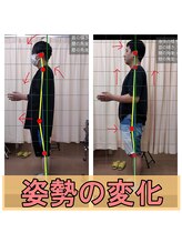 整体院 拓 太白院/ビフォアアフター