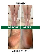 よもぐるみ/ビフォーアフター