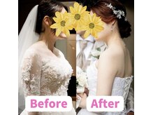ボディキュア ブライダル美容整体 大阪梅田/努力の継続で最高のドレス姿に◎