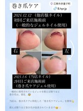 ダイヤモンドボディ/巻き爪ケア