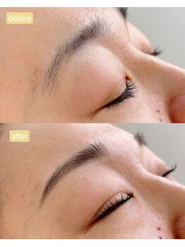 アンシャンテ(Anchante)/