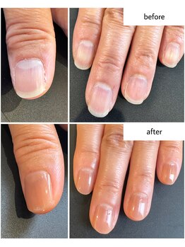 ケアプラス(care plus)/ケアカラー