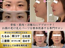 アンリエッタ(Unlieta)