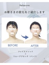 ボディケアルーム リフレキュア 中野(REFLECURE)/フェイスラインの変化