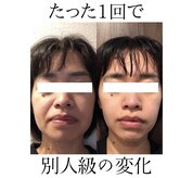 アルル 甲賀(ARuru)