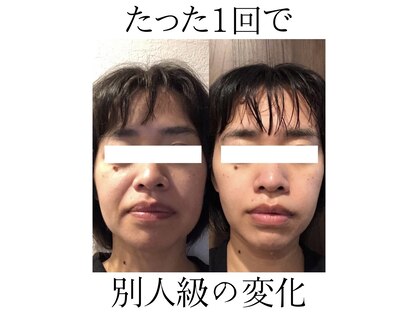 アルル 甲賀(ARuru)の写真