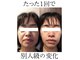 アルル 甲賀(ARuru)の写真