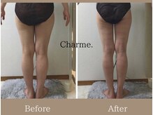 シャルム(CHARME)/お客様ビフォーアフター☆