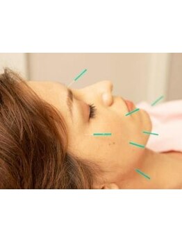 鍼灸施術を受けたい