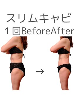 フロレゾン(Floraison)/引き締め痩身