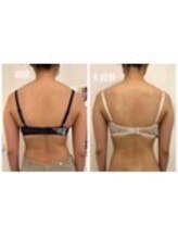 美人バスト 表参道店/バストアップ症例/育乳6回コース