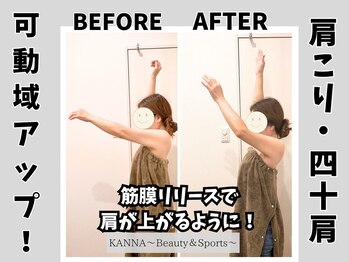 カンナ(KANNA)/50代　女性　施術例