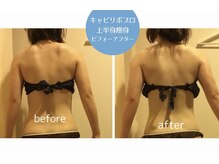 ボディデザインホームクレアフェリーチェ 神戸(Body design home Crea felice)/上半身マシン痩身・キャビリポ