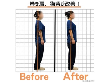 整体ハロ(整体HALO)/巻き肩/猫背