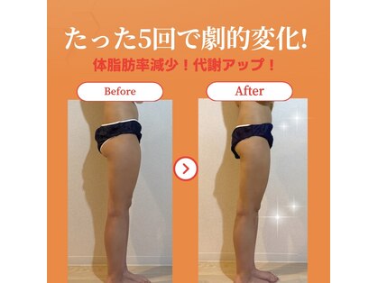 ヨサパーク モカ(YOSA PARK Moca)の写真