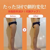 ヨサパーク モカ(YOSA PARK Moca)