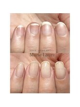 マリーロール 淀屋橋本店(Marie Laure)/深爪矯正/自爪育成/ネイルケア