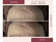 ウェルネス ステーション リンク(Wellness Station Link)/ビフォーアフター