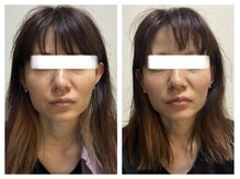 ペリドット(Peridot)/