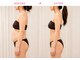 上野エステサロン レア(Lea)の写真