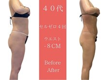 ムーン(MOON)/3ヶ月後の自分に驚きます。
