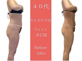 ムーン(MOON)/3ヶ月後の自分に驚きます。