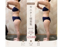 介正鍼灸整骨院 整体院 エフコープ大野城店