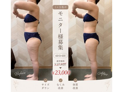 介正鍼灸整骨院 整体院 エフコープ大野城店の写真