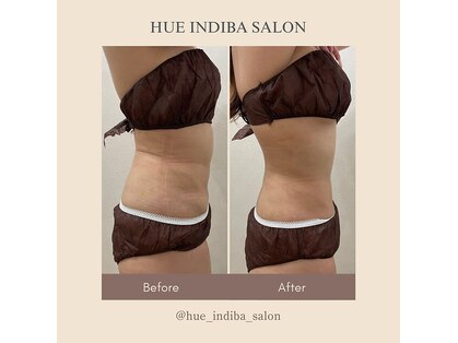 ヒューインディバサロン 横浜(HUE INDIBA SALON)の写真