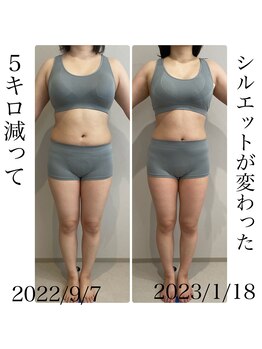 エミィシア(Emisia)/筋膜リリース