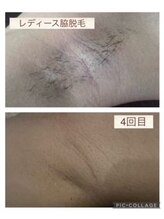 サーディン(sardine)/