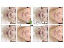 ワン(ONE)/ハーブピーリング