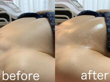 ハレオラ(HaleOla)/お客様の変化☆バストケア