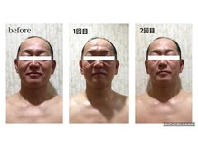 エステサロン ジョアアンジェ(joie ange)/メンズもコルギで小顔に!