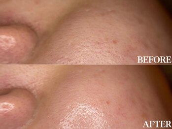 サロン ムスブ(salon MUSUBU)/山梨エステ/甲府エステ