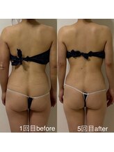 ミヨン(Miyong)/全身のぷよぷよお肉がすっきり