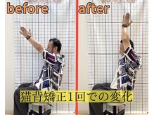 きずな鍼灸整骨院 武蔵ヶ丘本院/猫背矯正