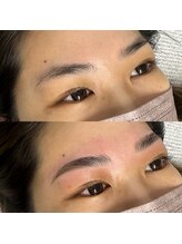 ジュリア(JULIA)/HBL（ハリウッドブロウリフト）