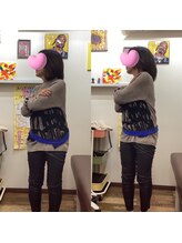 ヒデ整体院(Hide整体院)/猫背矯正骨盤矯正B/A肩こり腰痛