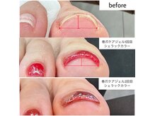 ケアプラス(care plus)の雰囲気（巻爪ケアしながらカラーリングも楽しめます♪）