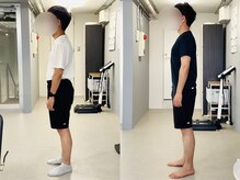 イレ 名古屋栄(ile)/男性の猫背も、9回で劇的変化。