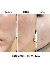 ビガク(BIGAKU)/透明感UPで肌色が違う