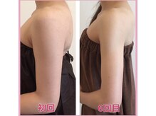 オードリリー(eau de Lily)の雰囲気（普段のお食事（栄養）の調整とリンパでリバウンドしにくい体に）